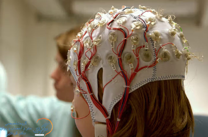 نوار مغز یا EEG چیست